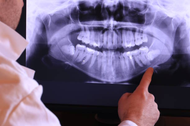 Tooth Infection Emergency Dentist in FL